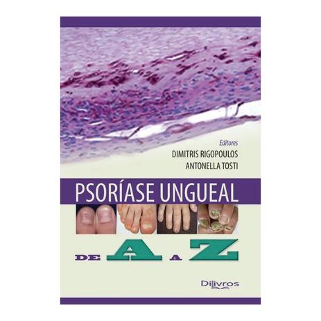 Livro - Psoriase Ungueal de A a Z - Rigopoulos - Dilivros Menor preço em Livro - Psoriase Ungueal de A a Z - Rigopoulos - Dilivros