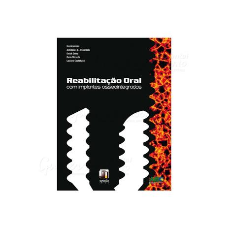 Livro - Reabilitação Oral com Implantes Osseointegrados - Alves Neto - Napoleão Menor preço em Livro - Reabilitação Oral com Implantes Osseointegrados - Alves Neto - Napoleão