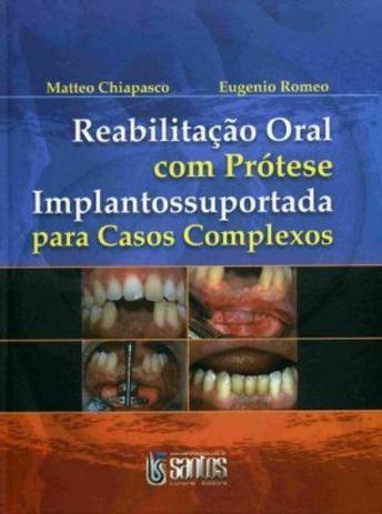 Livro - Reabilitação Oral com Prótese Implantossuportada Menor preço em Livro - Reabilitação Oral com Prótese Implantossuportada