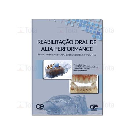 Livro - Reabilitação Oral de Alta Performance: Planejamento Reverso sobre Dentes e Implantes - Greco - Quintessence Menor preço em Livro - Reabilitação Oral de Alta Performance: Planejamento Reverso sobre Dentes e Implantes - Greco - Quintessence