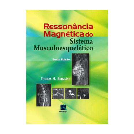 Livro - Ressonância Magnética do Sistema Musculoesquelético - Berquist - Revinter Menor preço em Livro - Ressonância Magnética do Sistema Musculoesquelético - Berquist - Revinter