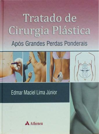 Livro - Tratado de cirurgia plástica após grandes perdas ponderais Menor preço em Livro - Tratado de cirurgia plástica após grandes perdas ponderais