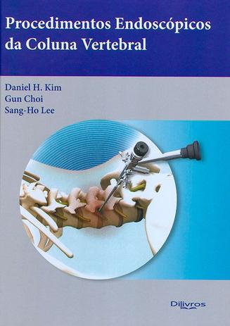 Procedimentos Endoscopicos Da Coluna Vertebral - Di livros Menor preço em Procedimentos Endoscopicos Da Coluna Vertebral - Di livros