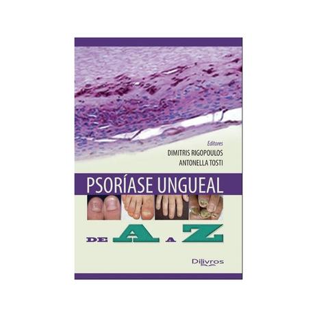 Psoríase Ungueal de A a Z - Di livros Menor preço em Psoríase Ungueal de A a Z - Di livros