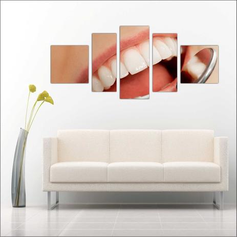 Quadro Decorativo Dentista Consultórios Decoração Odontologia 5 Peças T5 - Vital Menor preço em Quadro Decorativo Dentista Consultórios Decoração Odontologia 5 Peças T5 - Vital