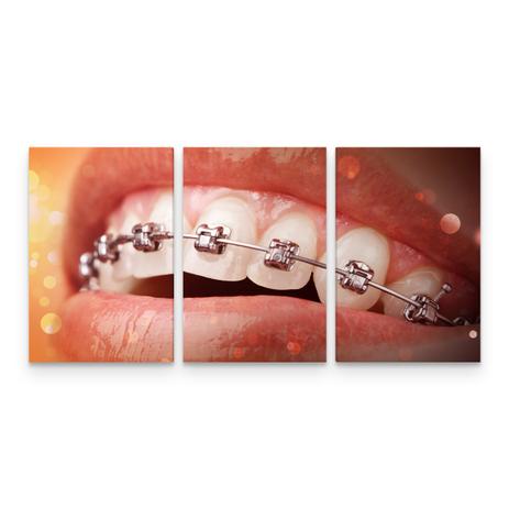 Quadro Odontologia Consultório Ortodontia Mosaico 3 Telas - Bimper Menor preço em Quadro Odontologia Consultório Ortodontia Mosaico 3 Telas - Bimper