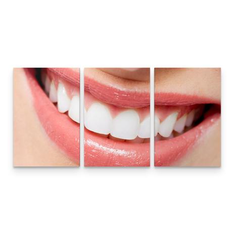 Quadro Odontologia Decorativo Consultório Sorriso em 3 Telas - Bimper Menor preço em Quadro Odontologia Decorativo Consultório Sorriso em 3 Telas - Bimper