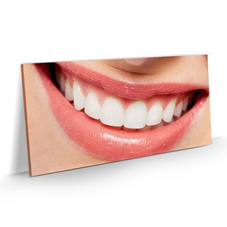 Quadro Odontologia Sorriso Consultório Decorativo 100x50 - Bimper Menor preço em Quadro Odontologia Sorriso Consultório Decorativo 100x50 - Bimper