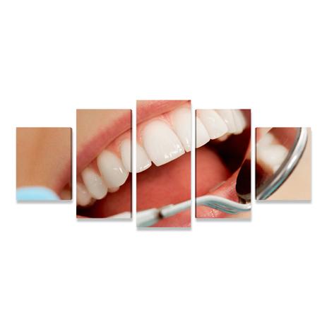 Quadro Odontologia Sorriso Mosaico 5 Telas Grande PEQ - Bimper Menor preço em Quadro Odontologia Sorriso Mosaico 5 Telas Grande PEQ - Bimper