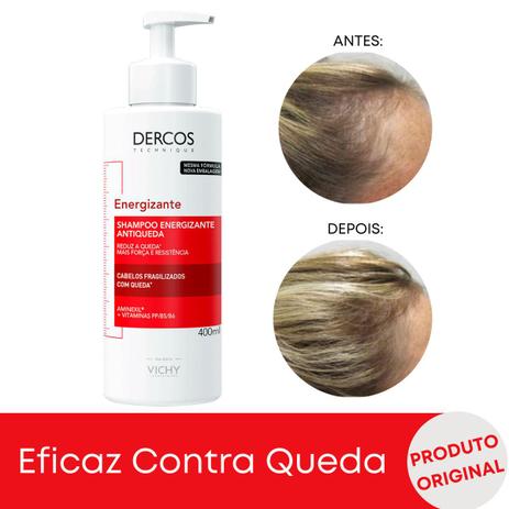 Shampoo Energizante Dercos Vichy Para Calvície Feminina 400ml é boa?