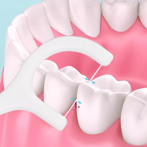 Imagem de 100 Pçs Fio Dental com Cabo Descartável Palito Dental Higiene Bucal