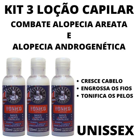 Imagem de 3 Loção Nasce Cresce E Fortalece Cabelo Em Queda Unissex Top