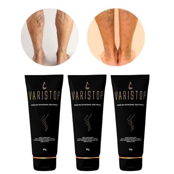 Imagem de 3un Creme Corporal Masculino Varistop p/ Combater Vasinhos