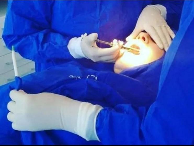 Imagem de 5 Campos Odontológicos Cirurgico Paciente Fenestrado tecido leve brim 140 cm x 90 cm furo 18 cm