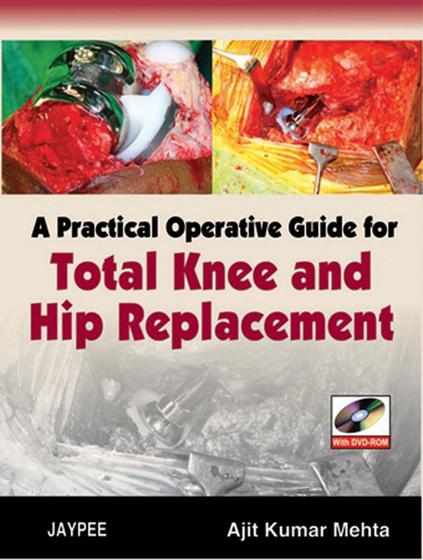Imagem de A practical operative guide for total knee and hip replacement