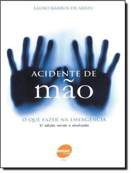 Imagem de Acidente de mao - o que fazer na emergencia - SENAC SP