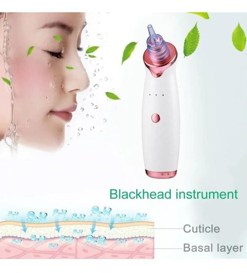 Imagem de Aparelho Removedor, Sugador de Cravos, Poros, Acne,Espinhas, Recarregavel USB Modelo KY3 Dermoabrasão Pelling