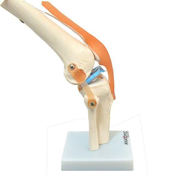 Imagem de Articulação Do Joelho Com Ligamentos Esqueleto Anatomia