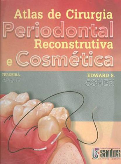 Imagem de Atlas de Cirurgia Periodontal Reconstrutiva e Cosmética - Santos