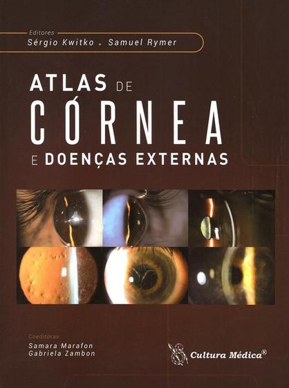Imagem de Atlas de cornea e doencas externas