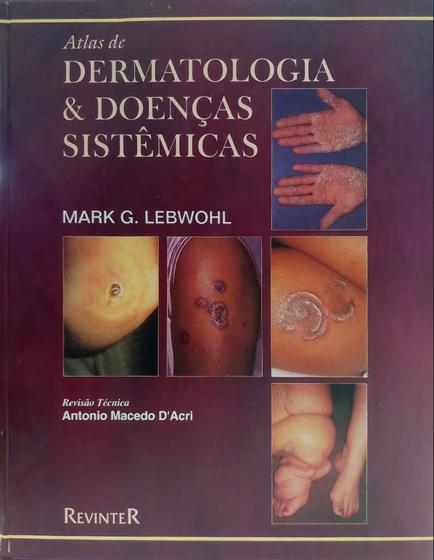 Imagem de Atlas de dermatologia e doencas sistemicas - REVINTER RJ