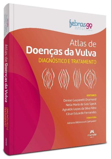 Imagem de Atlas De Doenças Da Vulva - Diagnóstico E Tratamento