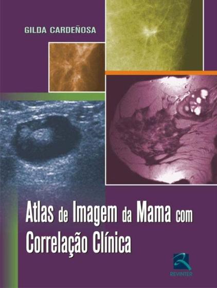Imagem de Atlas De Imagem Da Mama Com Correlação Clínica