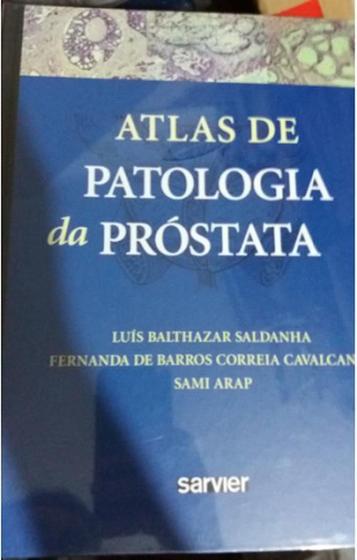 Imagem de Atlas De Patologia Da Próstata - Saldanha/Cavalcanti/Arap