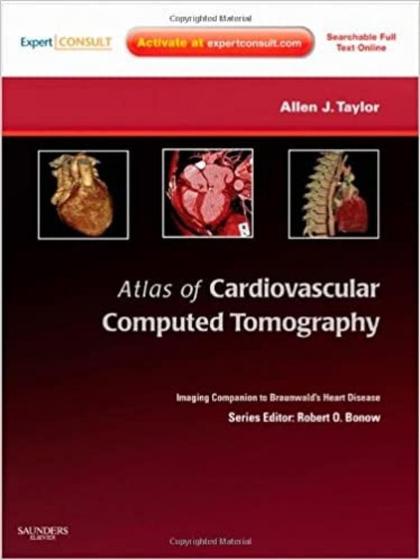 Imagem de Atlas of cardiovascular computed tomography: an imaging companion to ... - W.B. SAUNDERS