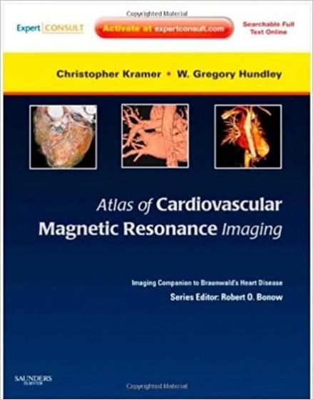 Imagem de Atlas of cardiovascular magnetic resonance imaging - W.B. SAUNDERS
