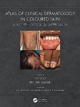 Imagem de Atlas of clinical dermatology in coloured skin - Taylor And Francis Group Llc