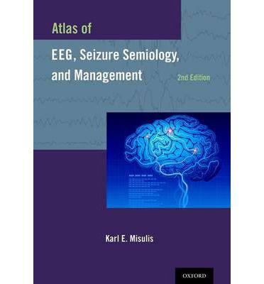 Imagem de Atlas of eeg, seizure semiology, and management - Oxford University Press Inc (import)