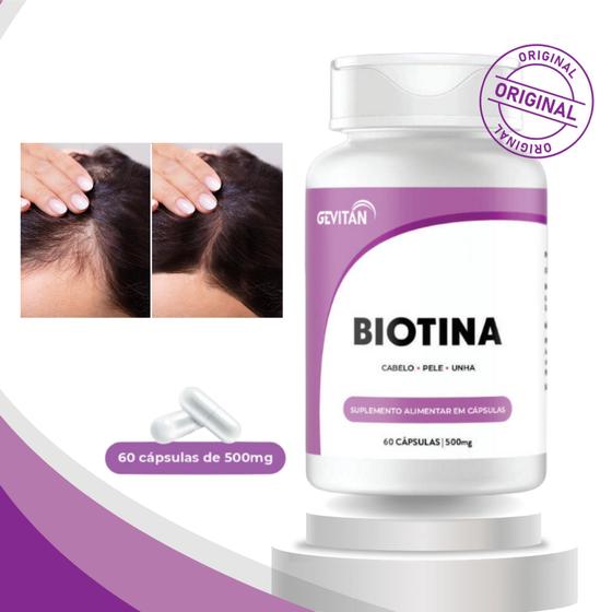 Imagem de Biotina Firmeza e Crescimento da Pele Cabelo e Unhas + Fortes Reduz Calvice Feminina