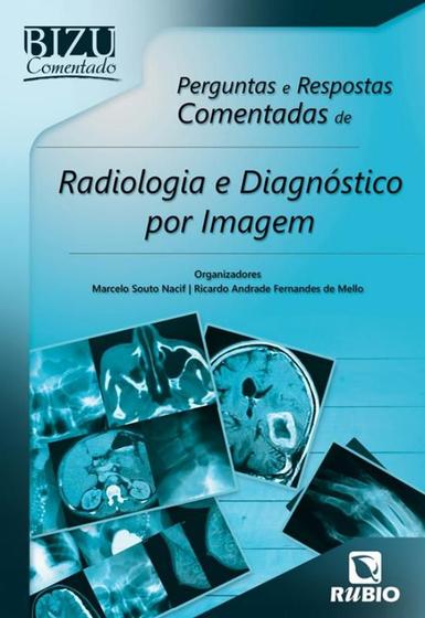 Imagem de Bizu comentado - perguntas e respostas comentadas de radiologia e diagnostico por imagem - RUBIO