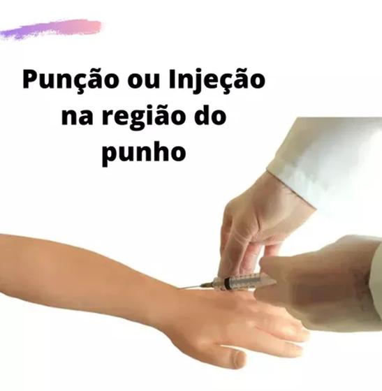 Imagem de Braço RCP