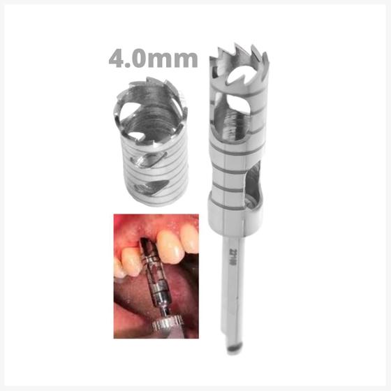 Imagem de Broca Trefina - Contra Ângulo Para Extração de Implantes, Coletar Osso para Enxerto, Biópsia - Odontológico