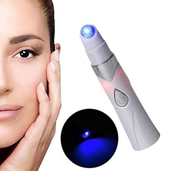 Imagem de Caneta laser Blue Light, anti-varizes e remoção de acne, dispositivo de beleza para cuidados com a pele