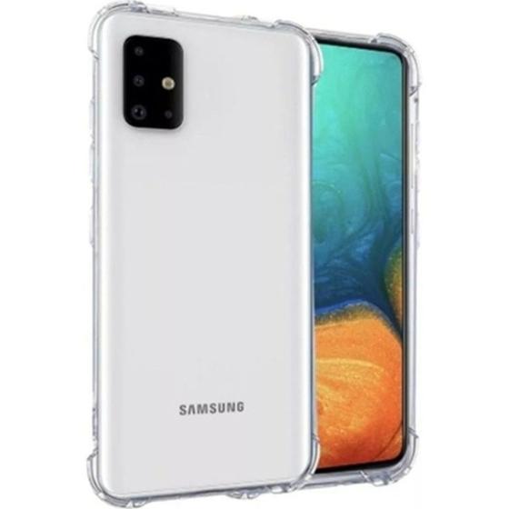 Imagem de Capa Capinha Case Anti Impacto Samsung Galaxy S10 Lite 6.7