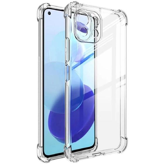 Imagem de Capa Capinha Case Anti Shock Transparente Mi 11 Lite