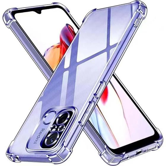 Imagem de Capa Transparente Luxuosa e Anti-Choque para Xiaomi Redmi Note 10/11/12S/12S Pro/13C