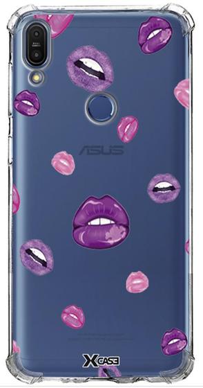 Imagem de Case Bocas - ASUS: ZENFONE 6 (630 KL)