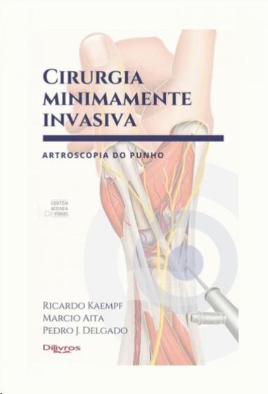 Imagem de Cirurgia minimamente invasiva artroscopia do punho