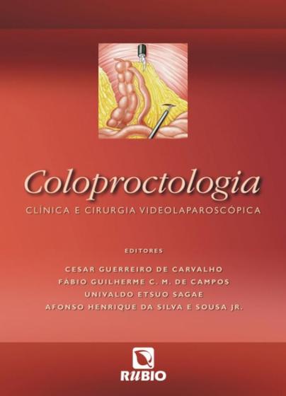 Imagem de Coloproctologia - clin cirurgia videolaparoscopica
