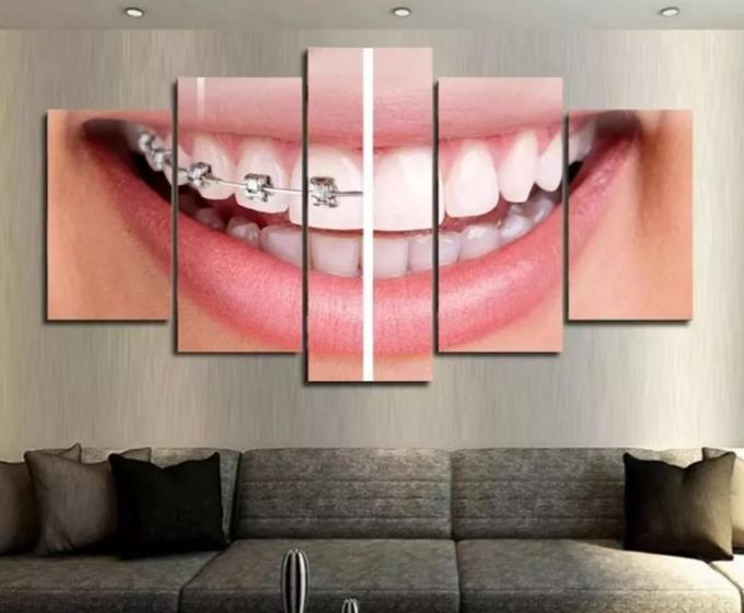 Imagem de Conjunto 5 Quadros Decorativos Dentista Aparelho "