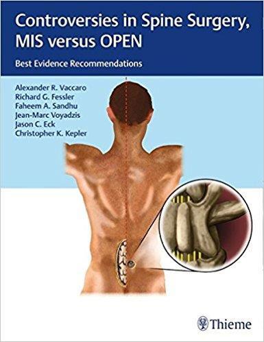 Imagem de Controversies in spine surgery mis versus open