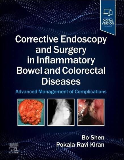 Imagem de Corrective endoscopy and surgery in inflammatory bowel and colorectal disea