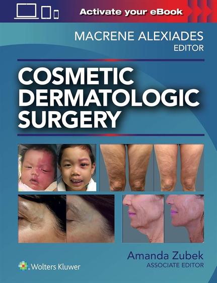 Imagem de COSMETIC DERMATOLOGIC SURGERY, Autor: MACRENE ALEXIADES MD, PHD, AMANDA ZUBEK MD, PHD