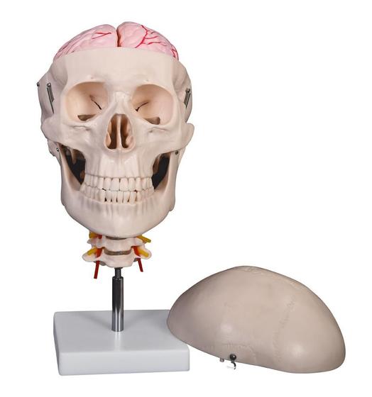 Imagem de Crânio com Coluna Cervical e Cérebro, em 8 Partes