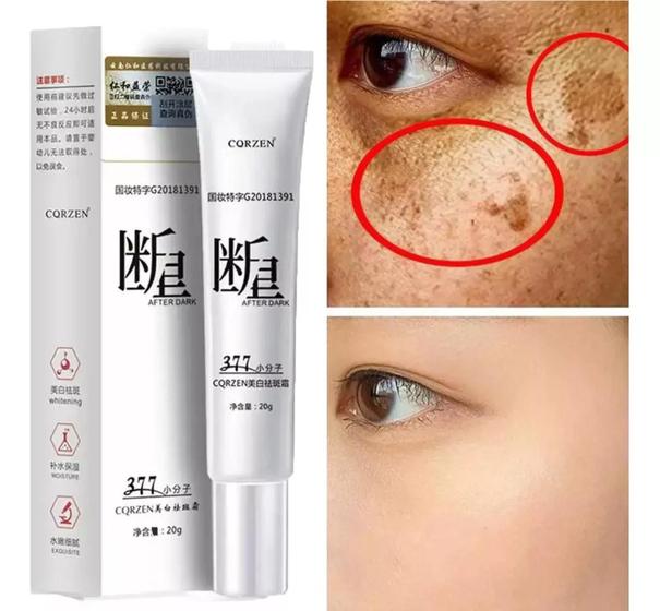 Imagem de Creme Tira Remove Manchas Melasma Sardas Corzen 20g