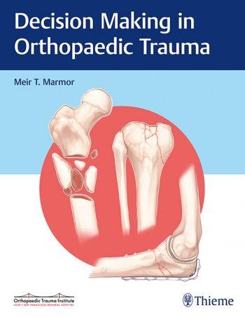 Imagem de Decision making in orthopaedic trauma - Thieme Publishers Inc/maple Press